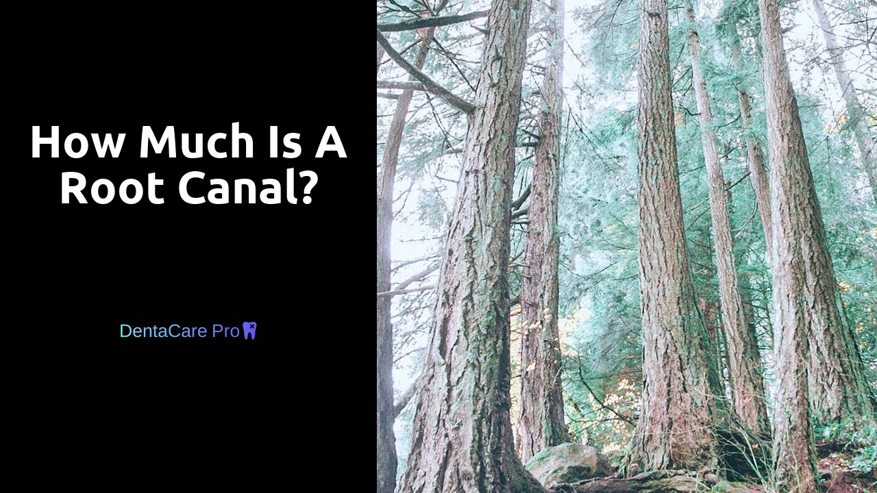 How much is a root canal?